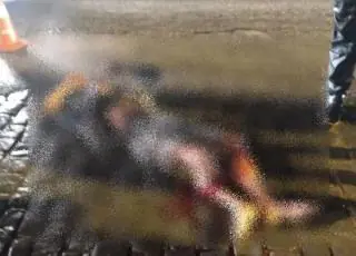 Motociclista tem fratura exposta na perna após perder controle da direção e bater em placa de sinalização