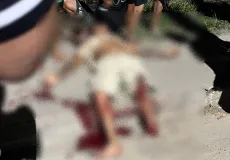 Motociclista tem pé decepado em grave acidente envolvendo dois carros em Eunápolis
