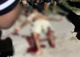 Motociclista tem pé decepado em grave acidente envolvendo dois carros em Eunápolis