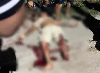 Motociclista tem pé decepado em grave acidente envolvendo dois carros em Eunápolis