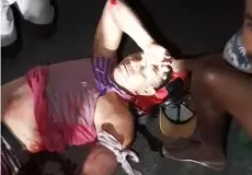 Motorista foge sem prestar socorro após acidente que deixa homem gravemente ferido na BA-283, em Guaratinga