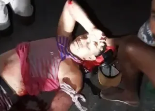 Motorista foge sem prestar socorro após acidente que deixa homem gravemente ferido na BA-283, em Guaratinga