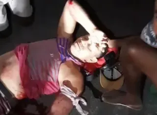 Motorista foge sem prestar socorro após acidente que deixa homem gravemente ferido na BA-283, em Guaratinga