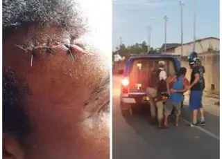 Mulher é agredida a pauladas e tem os seios mordidos pelo ex companheiro em Caravelas