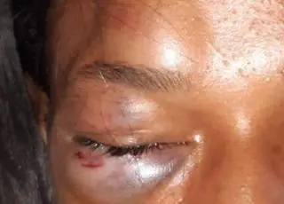 Mulher é agredida pelo marido. Agressor foi preso em Posto da Mata