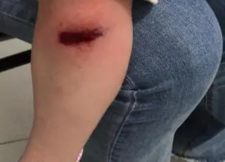 Mulher e criança ficam feridos em tentativa de assalto na BR 101 em Itamaraju