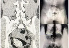 Mulher é presa após ser flagrada por Body Scan ao tentar entrar com drogas em unidade prisional na Bahia