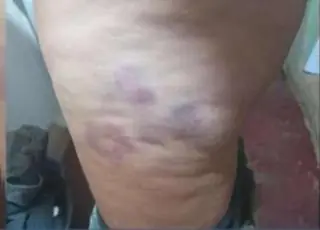 Mulher foge depois de passar três dias sendo espancada e estuprada em cárcere privado