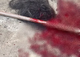 Mulher tem várias partes do corpo dilaceradas por cachorro da família em Itagimirim