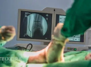 Ortopedia do HMTF registra mais de 480 atendimentos em setembro