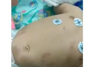 Pai é preso após espancar bebê de dois meses