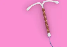 Pílula, diafragma ou DIU: quando cada método anticoncepcional é mais indicado  