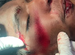 Polícia Civil prende suspeito de tentativa de homicídio poucas horas após o crime na Bahia