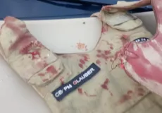 Policial militar é baleado na cabeça durante confronto armado em Salvador