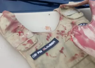 Policial militar é baleado na cabeça durante confronto armado em Salvador