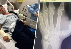 Popó passa por cirurgia após sangramento interno e fratura na mão durante briga generalizada com Wanderlei Silva 