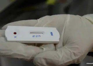 Saúde orienta farmácias sobre testes para HIV, sífilis e hepatites