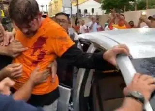 Senador Cid Gomes é baleado ao  entrar em batalhão da polícia com retroescavadeira