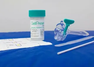 SUS amplia prevenção ao câncer de colo do útero com teste gratuito de DNA-HPV