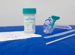 SUS amplia prevenção ao câncer de colo do útero com teste gratuito de DNA-HPV