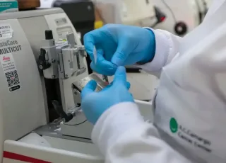 SUS inclui nova terapia para pacientes adultos com leucemia mieloide
