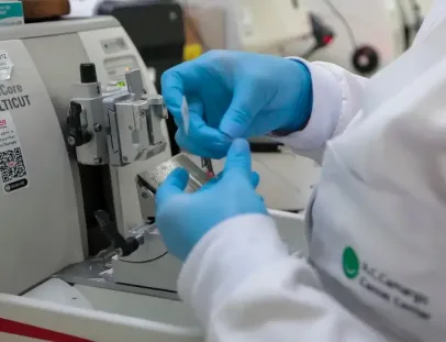 SUS inclui nova terapia para pacientes adultos com leucemia mieloide