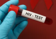 Informação de surto de HIV entre jovens na Bahia não procede, diz Secretaria de Saúde