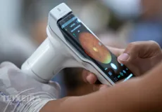 Teixeira de Freitas realiza atendimento oftalmológico para 667 pacientes com glaucoma