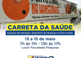 Teixeira de Freitas receberá a “Carreta de Saúde” para diagnóstico e tratamento da Hanseníase