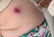 Turistas são baleadas em área próxima à Barra do Cahy e caso gera tensão no município de Prado