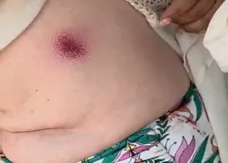 Turistas são baleadas em área próxima à Barra do Cahy e caso gera tensão no município de Prado