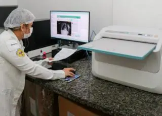 UMMI conta com um Digitalizador de Raio-X para facilitar diagnósticos de pacientes