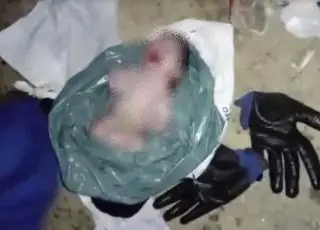 Vídeo - Recém-nascido é encontrado por garis dentro de sacola no meio do lixo