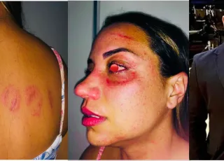 Vítima de violência doméstica rebate acusações e esclarece fatos sobre caso envolvendo médico de Teixeira de Freitas